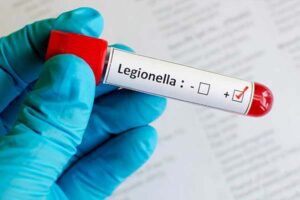 Control-de-Legionella-en-Extremadura-3